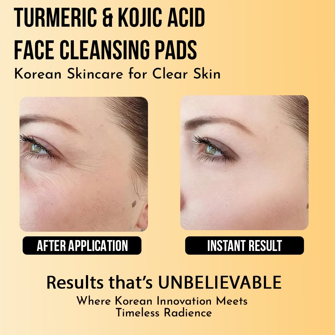 WILDGLOW Turmeric & Kojic Acid Face Cleansing Pads for Dark Spots, Skin Brightening & Acne Prevention | Vitamin C, Retinol & Chamomile Hydrolat | For Women & Men | All Skin Type | 40 Pieces Pack of 1