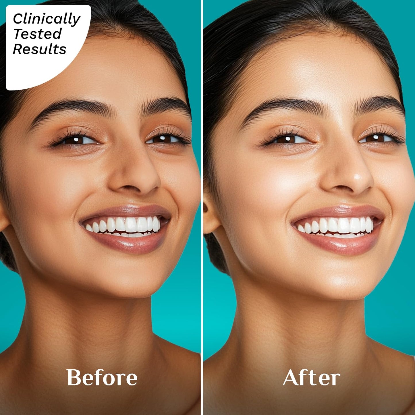 Pilgrim Squalane Niacinamide & Vitamin C Glow Moisturizer for face | Moisturizer for dry skin hydration | Face moisturizer with vitamin c for glowing skin | Non-greasy | For Women and Men I 50 gm