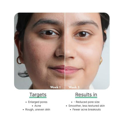 Cos-IQ 5% Niacinamide Face Serum for Clear Glowing Skin, Reduces Dullness, Hydrates & Repairs Skin with Vit B3 & Hyaluronic Acid, Day & Night Serum | For Women & Men | 30ml