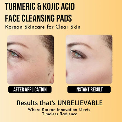 WILDGLOW Turmeric & Kojic Acid Face Cleansing Pads for Dark Spots, Skin Brightening & Acne Prevention | Vitamin C, Retinol & Chamomile Hydrolat | For Women & Men | All Skin Type | 40 Pieces Pack of 1