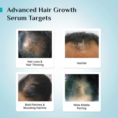 Pilgrim Advanced Hair Growth Serum with Redensyl 3%, Anagain 4% & Baicapil | Hair Fall Control & Regrowth | Korean Black Rice | For Men & Women, 1.69 Fl Oz (50ml)