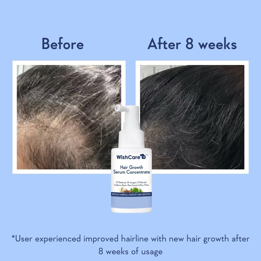 Hair Growth Serum Concentrate - Rosemary, 3% Redensyl, 4% Anagain, 2% Baicapil, Caffeine, Biotin, Plant Keratin & Rice Water