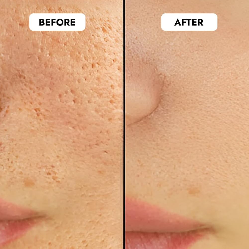 Cos-IQ 5% Niacinamide Face Serum for Clear Glowing Skin, Reduces Dullness, Hydrates & Repairs Skin with Vit B3 & Hyaluronic Acid, Day & Night Serum | For Women & Men | 30ml