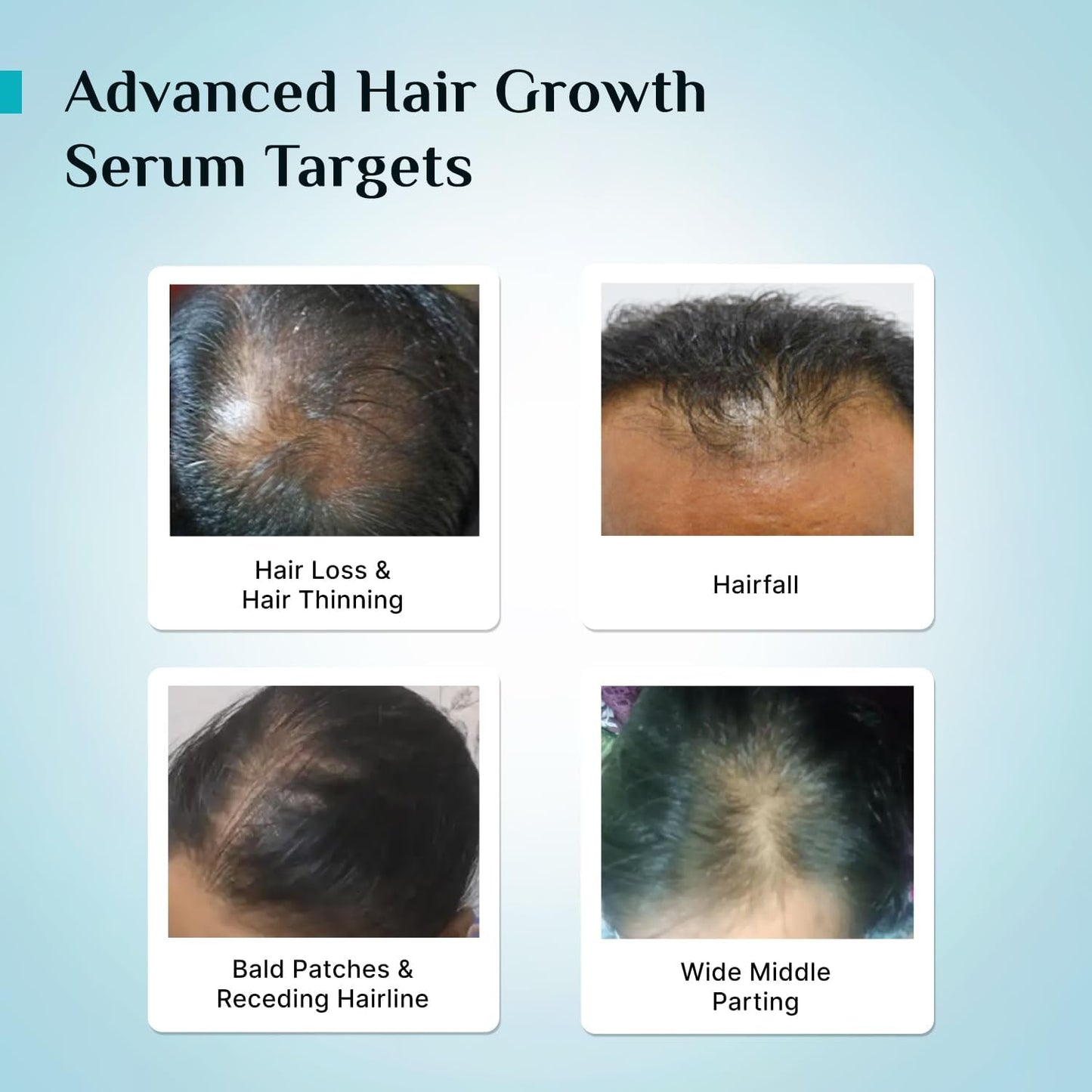 Pilgrim Advanced Hair Growth Serum with Redensyl 3%, Anagain 4% & Baicapil | Hair Fall Control & Regrowth | Korean Black Rice | For Men & Women, 1.69 Fl Oz (50ml)