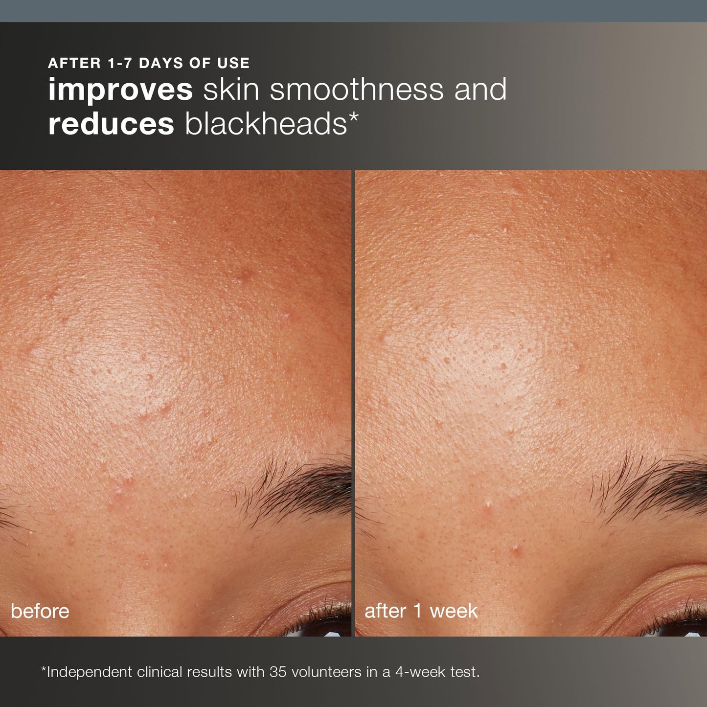Dermalogica Daily Microfoliant, Face Exfoliator Scrub Powder with Salicylic Acid and Papaya Enzyme, Achieve Brighter, Smoother Skin Daily
